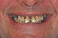 Smile In A Day 3 before